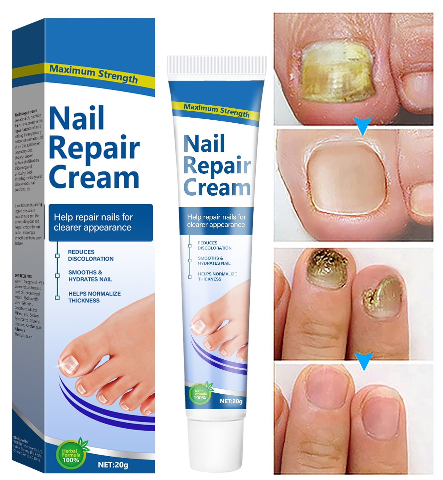 Quickly effective】Nail repair treatment cream Onychomycosis cream 30g Anti  fungal for nails Paronychia Treatment Nail fungus repair treatment Anti fungal  cream Foot Hand Foot Care Onychomycosis removal Nail care serum | Lazada