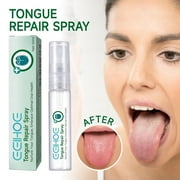 Tongue Repair Spray 30ml Reduce Swelling Tongue Relief Treatment Spray for Bad Breath