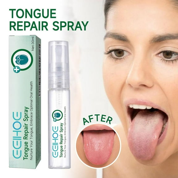 Tongue Repair Spray 30ml Reduce Swelling Tongue Relief Treatment Spray for Bad Breath