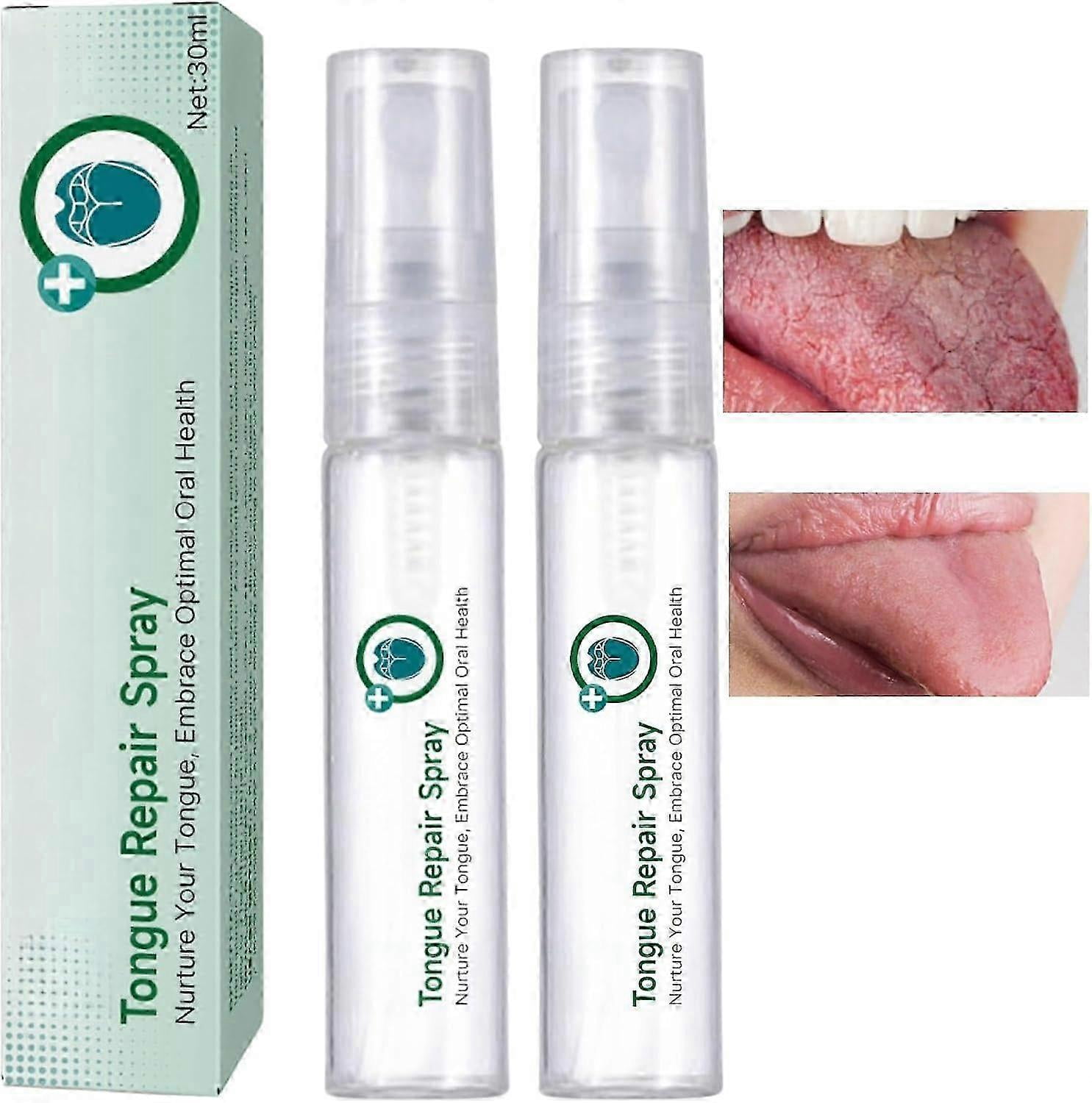 Tongue Repair Spray, Mouth Odor Eliminator for Dryness& Bad Breath,Fissured Tongue Relief Spray, Instant Dry Mouth Relief,Breath Freshener Spray