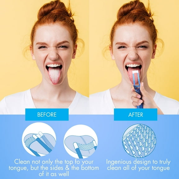 Tongue Scraper W/ Soft Brushes