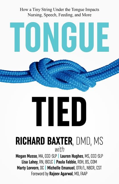 Tongue-Tied: How a Tiny String Under the Tongue Impacts Nursing, Speech, Feeding, and More (Paperback)