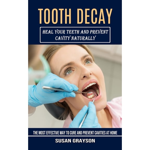 Tooth Decay: Heal Your Teeth and Prevent Cavity Naturally (The Most Effective Way to Cure and Prevent Cavities at Home), (Paperback)