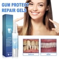 thumbnail image 1 of Tooth Repair Gel Containing Plants Nourishes Gums Deeply Maintains And Whitens Teeth Cuidado bucal - Oral Care, 1 of 9