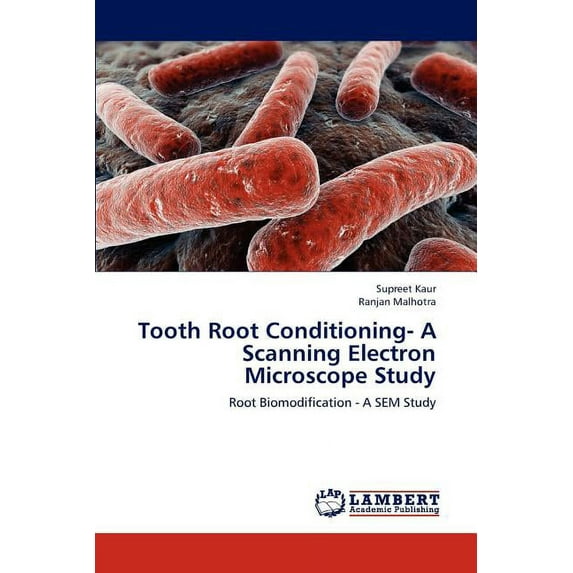 Tooth Root Conditioning- A Scanning Electron Microscope Study (Paperback)