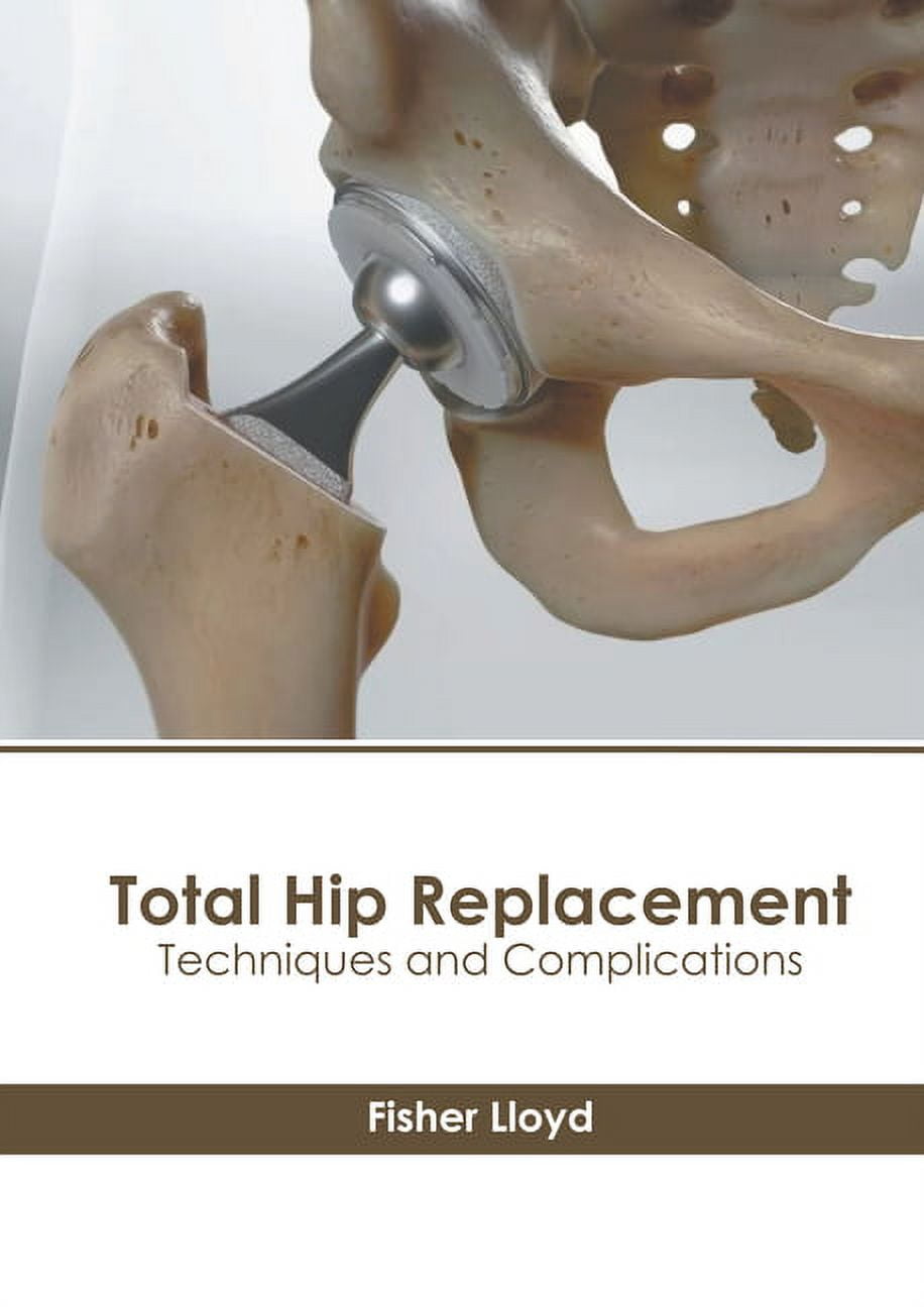 Total Hip Replacement Techniques and Complications (Hardcover