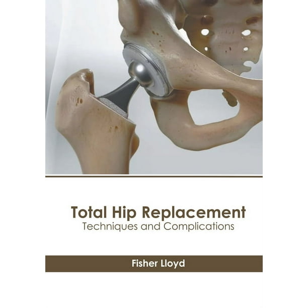 Total Hip Replacement Techniques and Complications (Hardcover