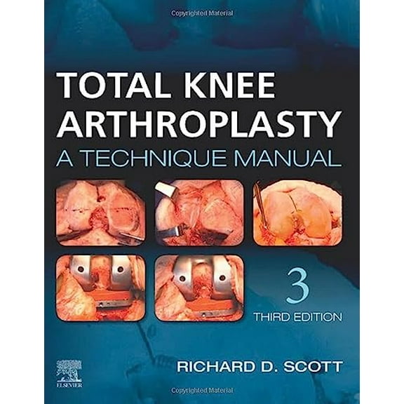 Pre-Owned Total Knee Arthroplasty