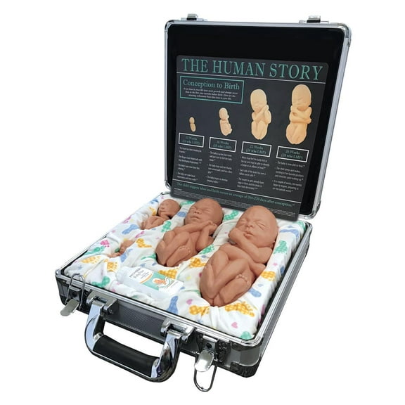 Touch of Life, Main Set, Brown Pro-Life Fetal Model
