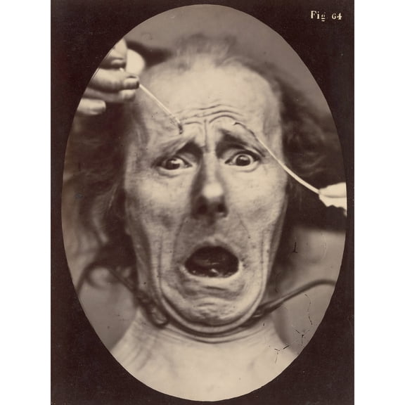 Tournachon Electro Physiology Facial Expressions 1862 Photo Extra Large XL Wall Art Poster Print
