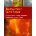 thumbnail image 1 of Transcatheter Valve Repair, (Hardcover), 1 of 1