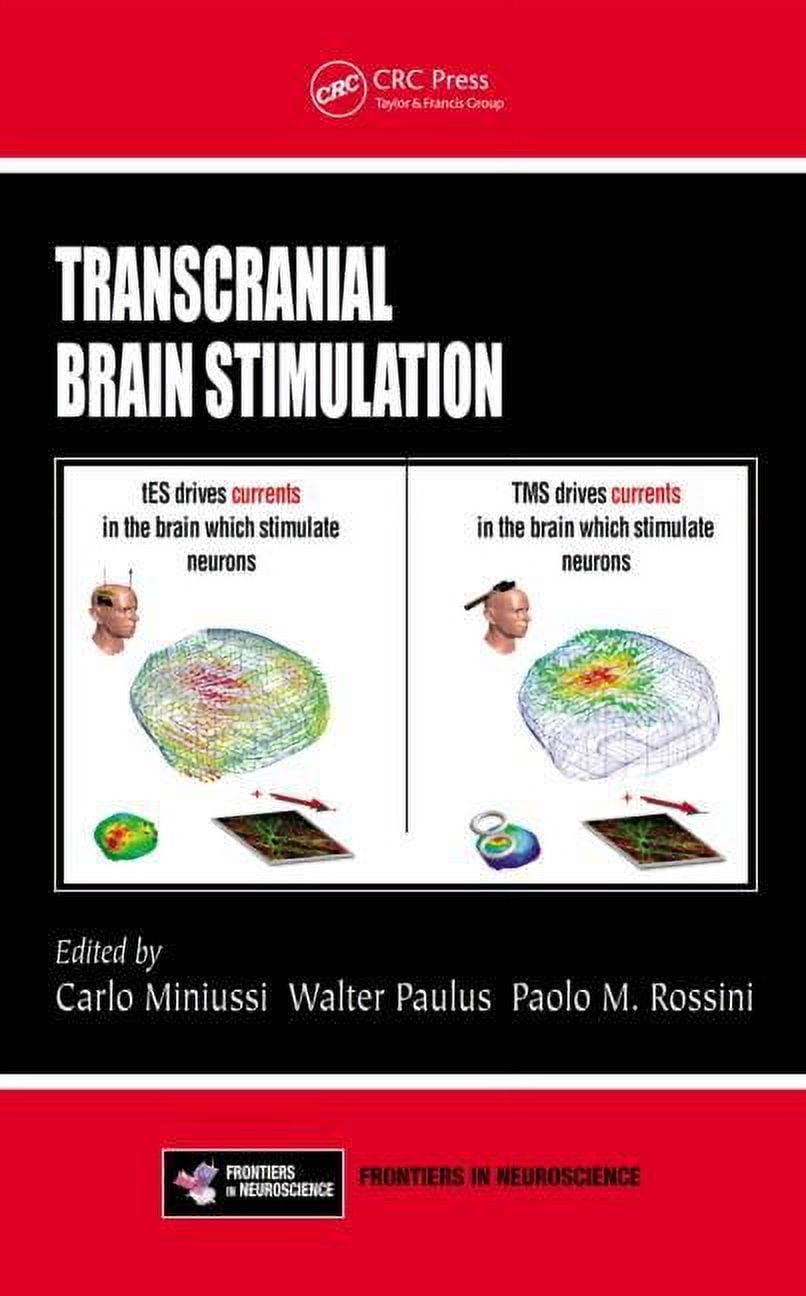 Transcranial Brain Stimulation, (Hardcover) - Walmart.com