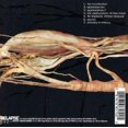 thumbnail image 1 of Transfer Trachea Reverberations, 1 of 1