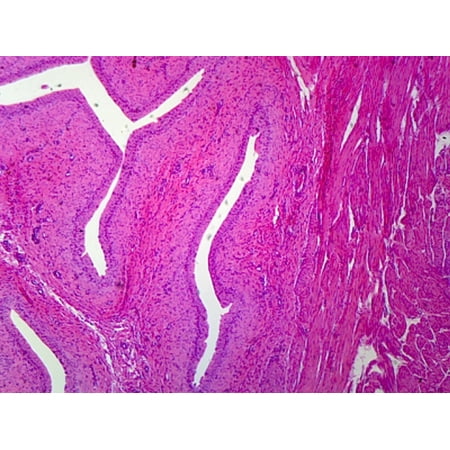 Transitional Epithelium, Mammalian; Stratified Cuboidal Epithelium from Urinary Bladder; Section by Go Science Crazy
