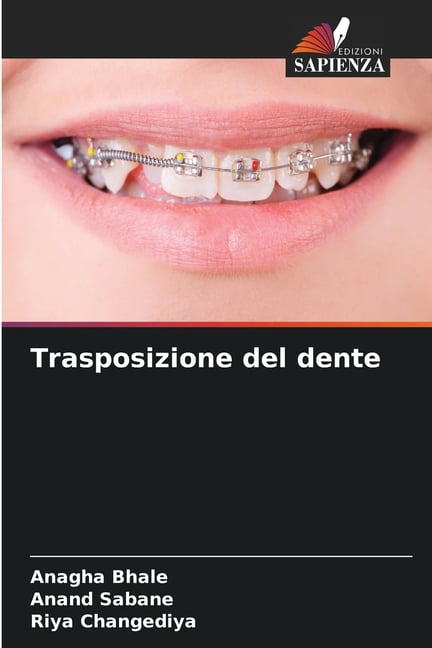 Trasposizione del dente, (Paperback)