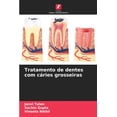 thumbnail image 1 of Tratamento de dentes com cÃ¡ries grosseiras, (Paperback), 1 of 1