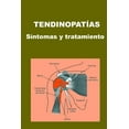 thumbnail image 1 of Tratamiento Natural: Tendinopatías: Síntomas y tratamiento (Paperback), 1 of 1