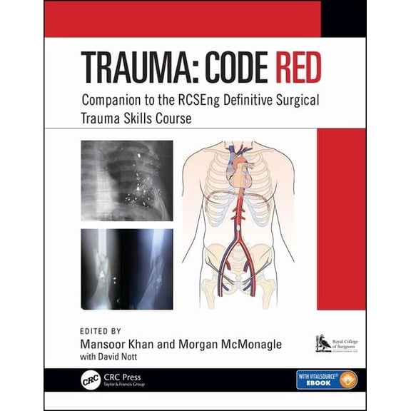 Trauma: Code Red: Companion to the Rcseng Definitive Surgical Trauma Skills Course (Paperback)