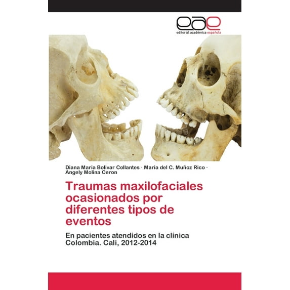 Traumas maxilofaciales ocasionados por diferentes tipos de eventos (Paperback)