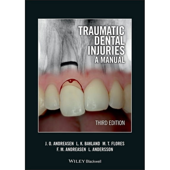 Traumatic Dental Injuries: A Manual (Other)