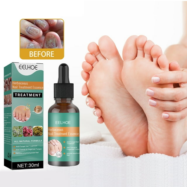 Travelwant 30ML Extra Strength Toenail Fungus Treatment Nail Fungus