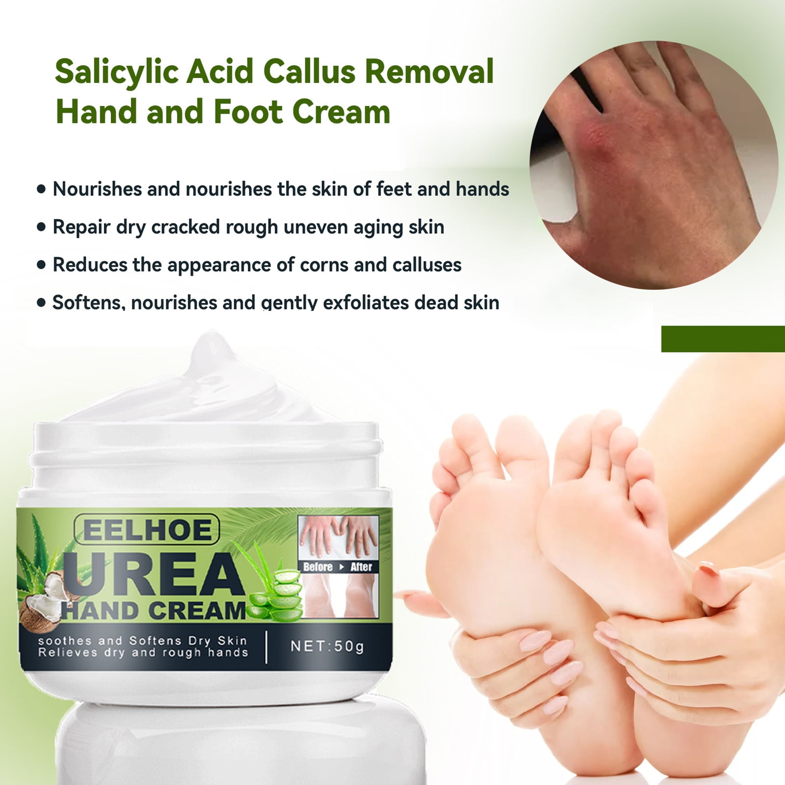 Anti Fungal Foot Repair Foot Cream Dead Skin Removal Peeling