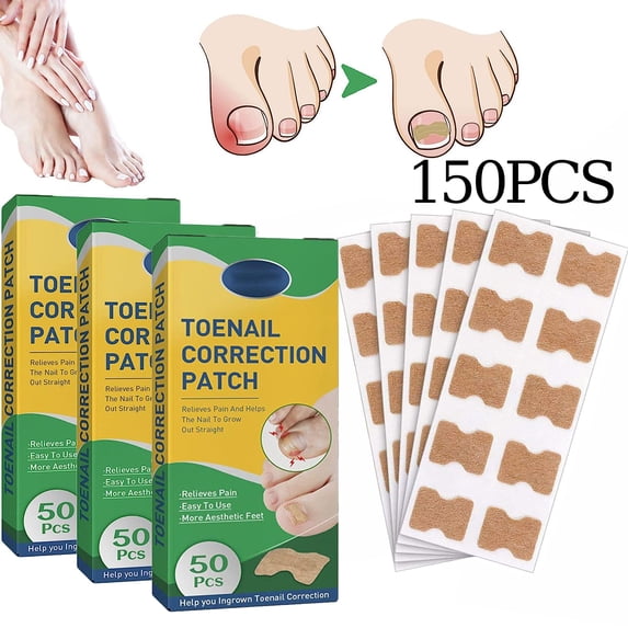 Treatment Ingrown Toenail Corrector Strips,Fitmedify Nail Patches with Nail Correction Tool Kit,Toenail Correction Patch,Ingrown Toenail Removal Kit, 150PCS
