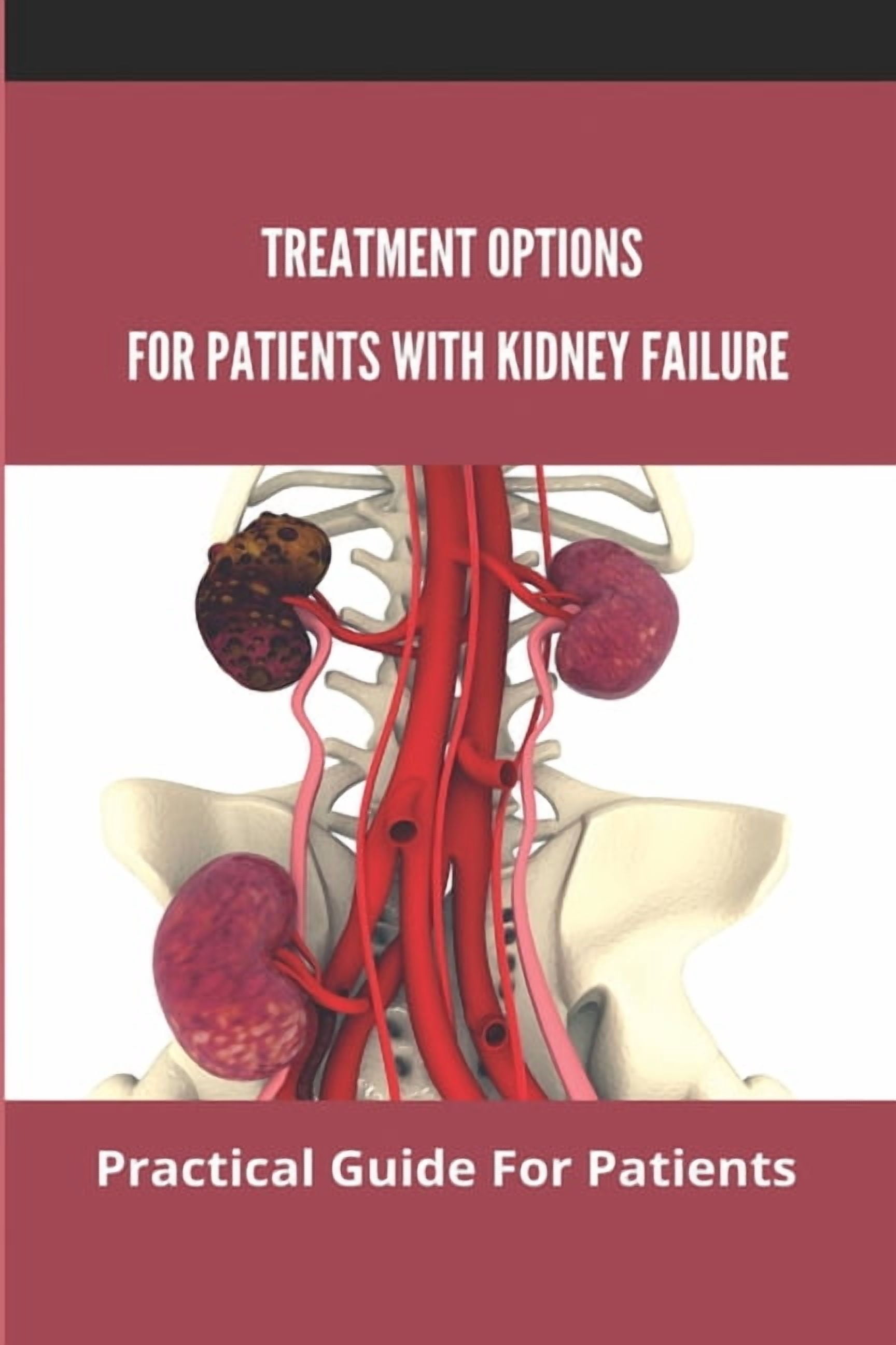 Treatment Options For Patients With Kidney Failure: Practical Guide For ...