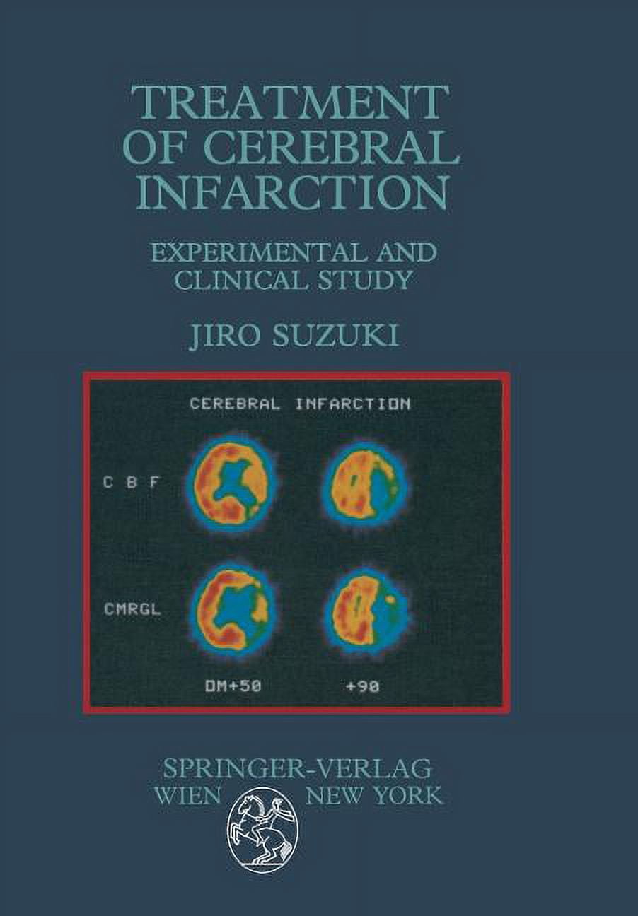 Treatment of Cerebral Infarction: Experimental and Clinical Study, (Paperback)