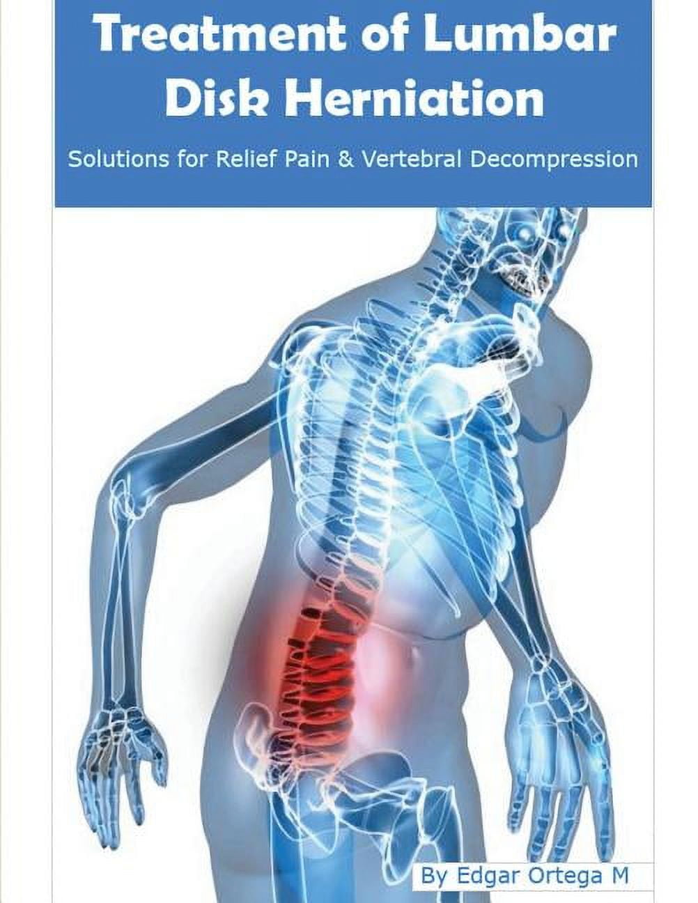 Chiropractic Treatment for Disc Herniation - Advanced Wellness Solutions