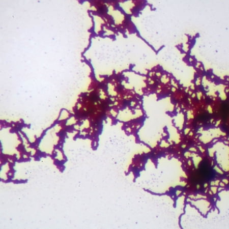 Treponema, W.M. Microscope Slide