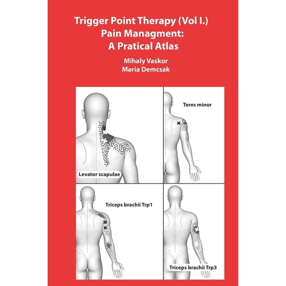 Trigger Point Therapy (Vol I.) Pain Managment: A Pratical Atlas (Paperback)