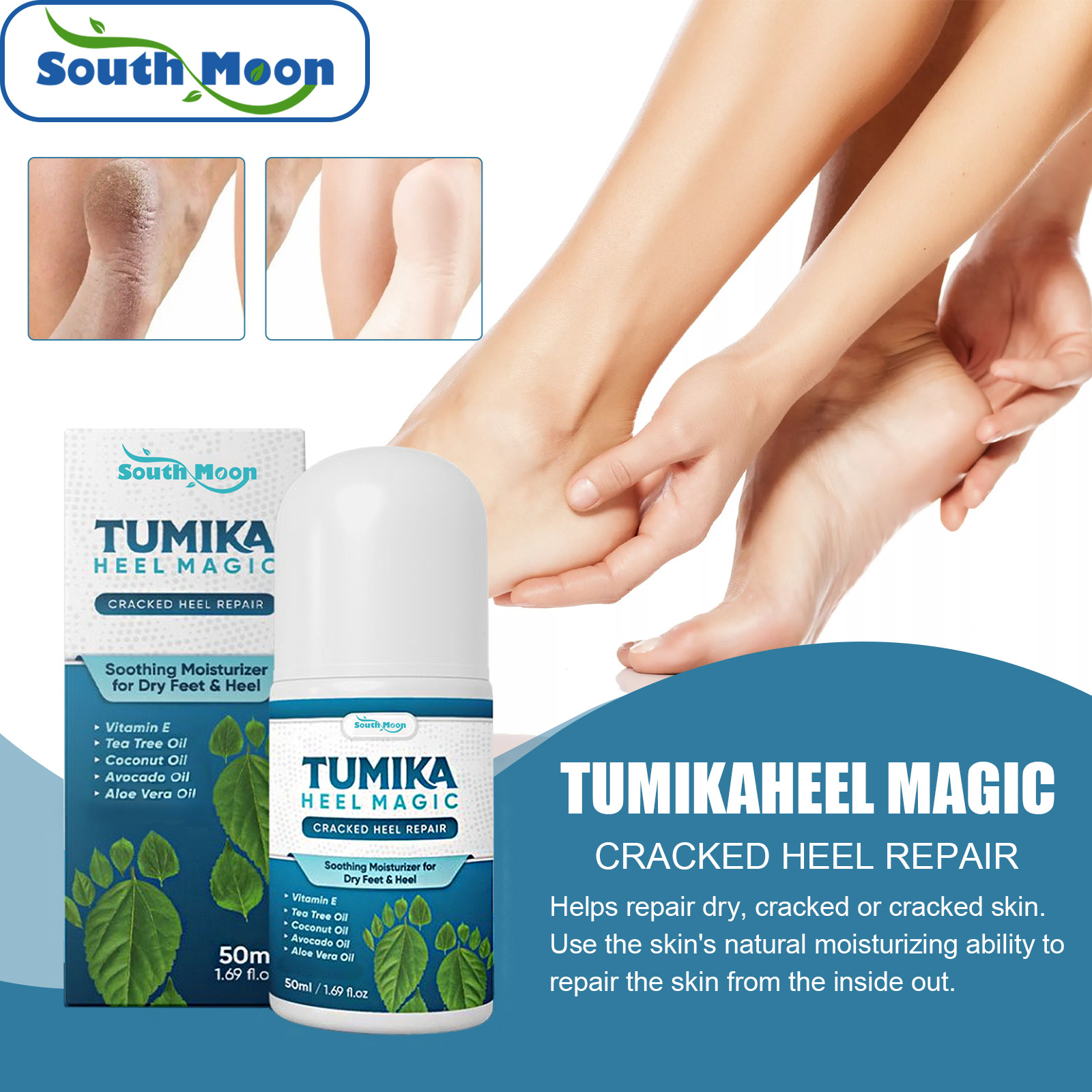 Trosgynnu Moisturizing Cream for Dry and Cracked Feet Moisturizing Anti
