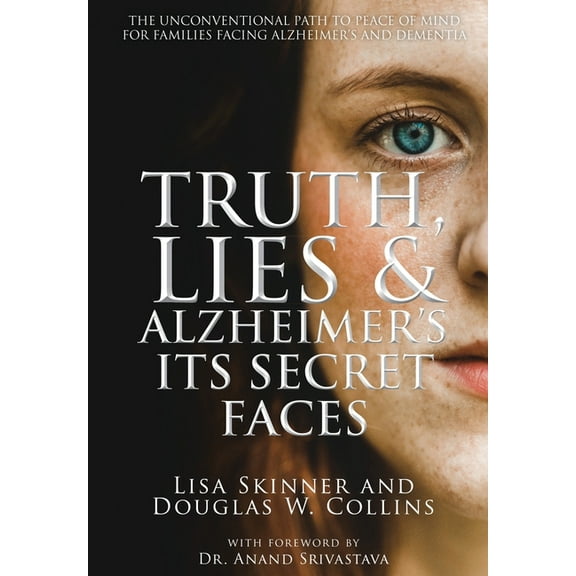 Truth, Lies & Alzheimer's: Its Secret Faces, (Hardcover)