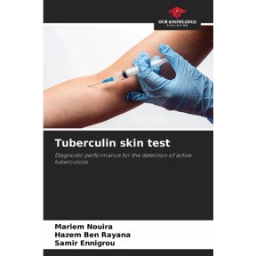 Tuberculin skin test, (Paperback)
