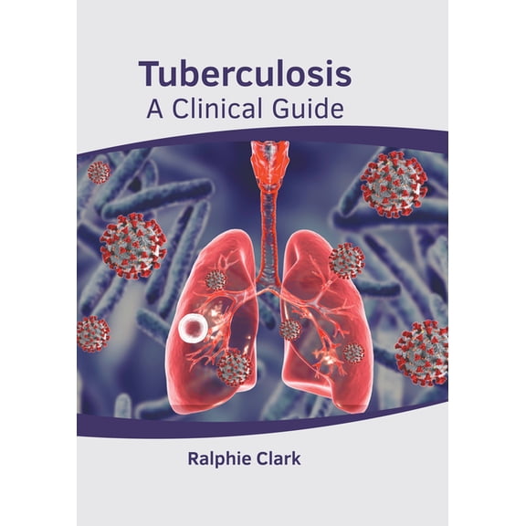 Tuberculosis: A Clinical Guide, (Hardcover)