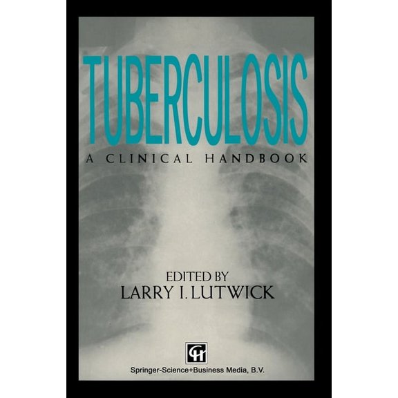 Tuberculosis, (Paperback)