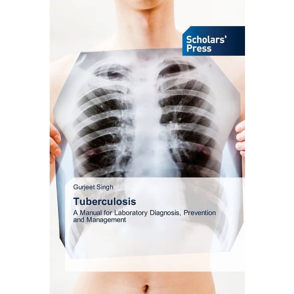 Tuberculosis (Paperback)