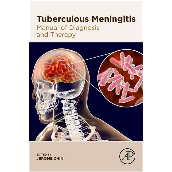 Tuberculous Meningitis: Manual of Diagnosis and Therapy, (Paperback)