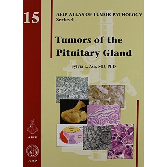 Pre-Owned Tumors of the Pituitary Gland (Hardcover) 1933477156 9781933477152