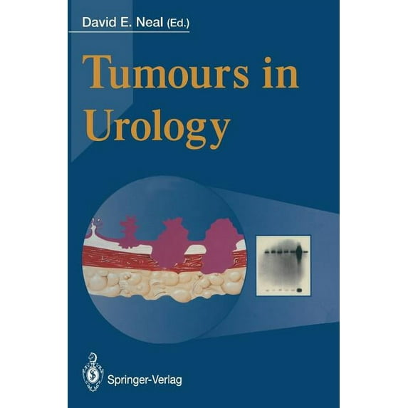 Tumours in Urology, (Paperback)