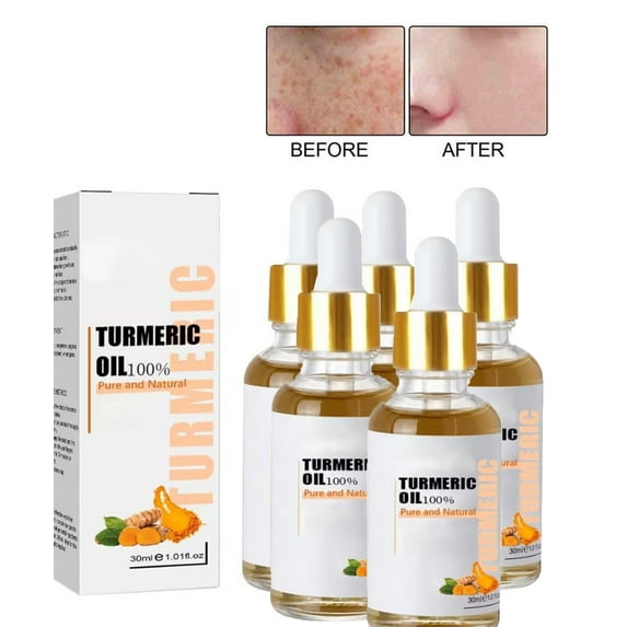Turmeric Serum for Dark Spots,Turmeric Dark Spot Corrector SerumTurmeric Dark Spot Corrector Serum Oil for Face, Moisturizing Massage Essence, Natural Facial Serum for Women & Men,5PCS