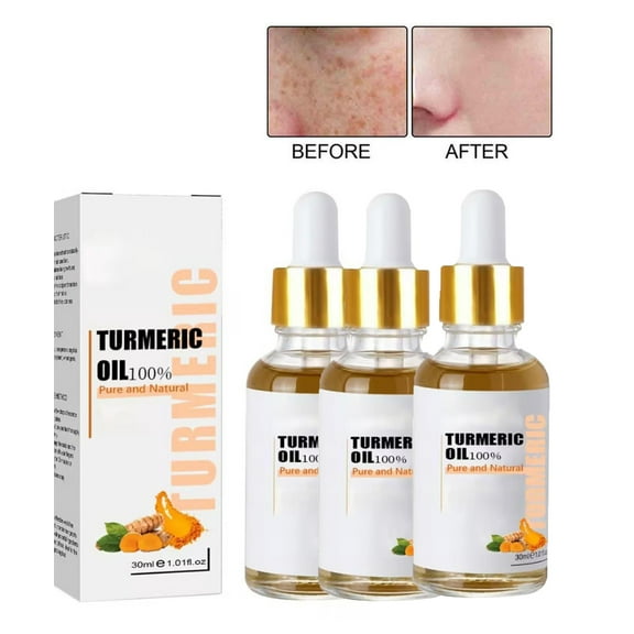 Turmeric Serum for Dark Spots,Turmeric Dark Spot Corrector SerumTurmeric Dark Spot Corrector Serum Oil for Face, Moisturizing Massage Essence, Natural Facial Serum for Women & Men,3PCS