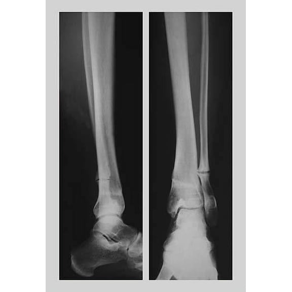 Two Ankles-Fine Art Canvas Print (20" x 30")