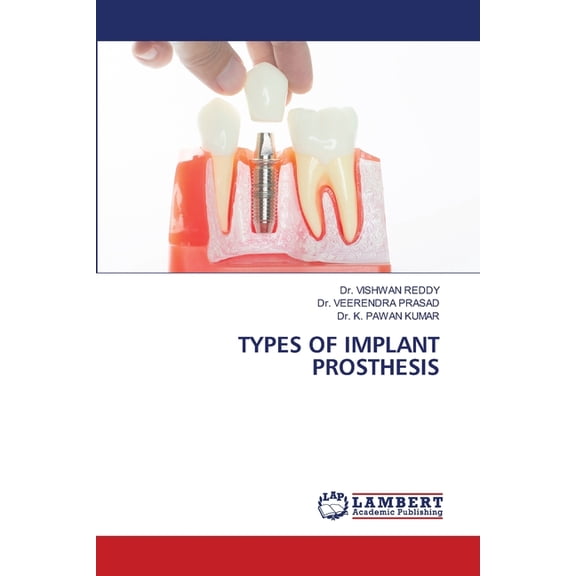 Types of Implant Prosthesis, (Paperback)