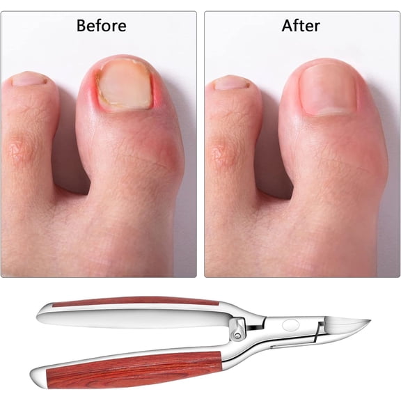 UBSWF-Nail Clipper,Toenail Clippers for Thick and Ingrown Nails,Heavy Duty Podiatrist Toenail Nippers for Seniors Fingernails,Toenails Pedicure,Wooden Handle,Sharp Blade
