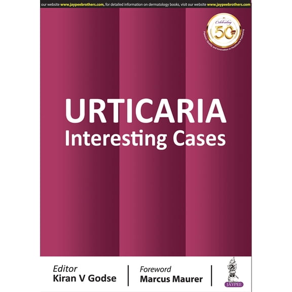 URTICARIA INTERESTING CASEs