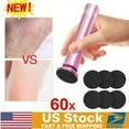 thumbnail image 1 of USB Electric Foot Pedicure | Adjustable Speed ​​​​Exfoliator | Includes 60 Sandpaper Sheets | Portable Aluminum Alloy Pedicure Tool | Pink, 1 of 11