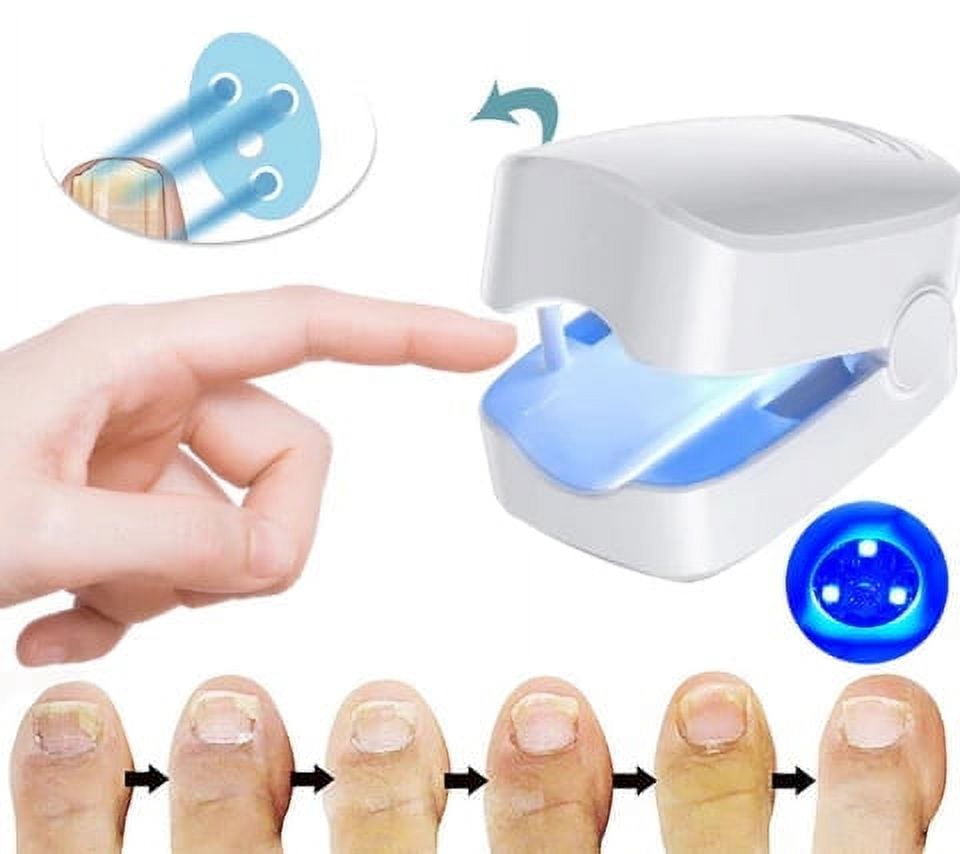Uv Light To Kill Nail Fungus UV Light Nail Fungus Cleaning Laser Device, Home Use Nail Fungus