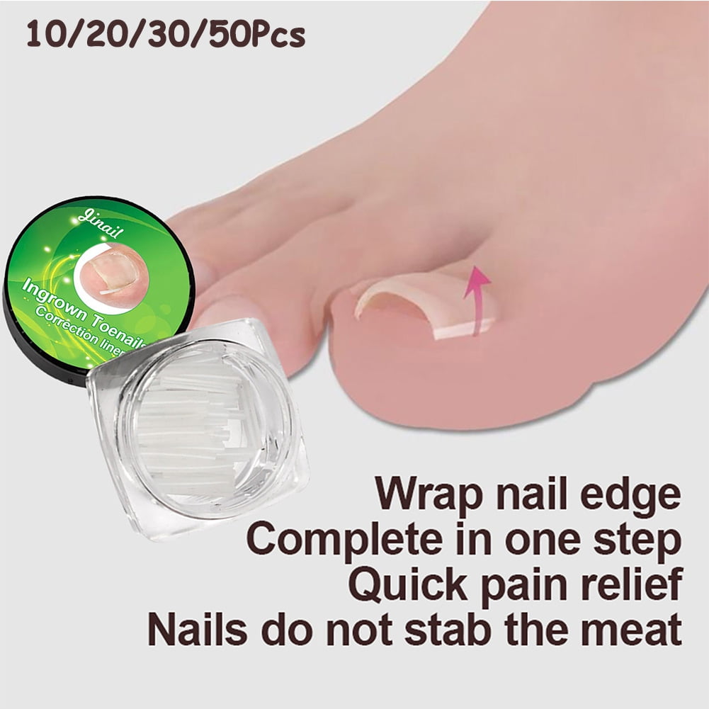 Uehgn Ingrown Toenail Tool Corrector Treatment Kit, Nail Filler for